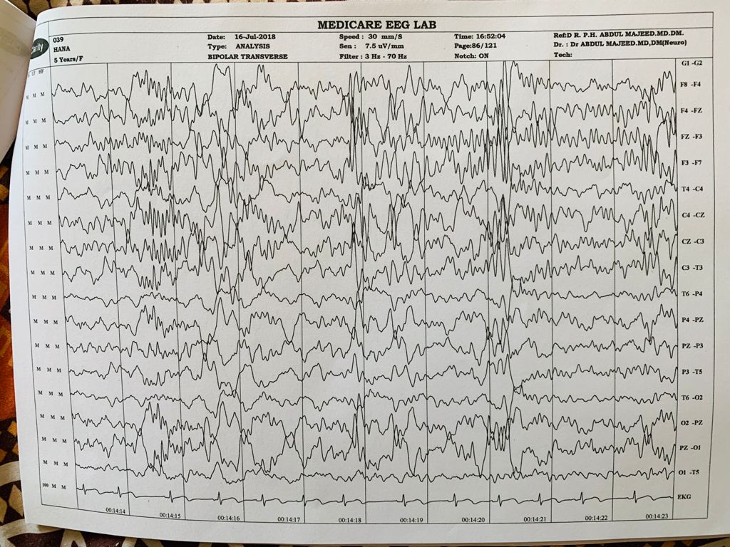 Patient Story